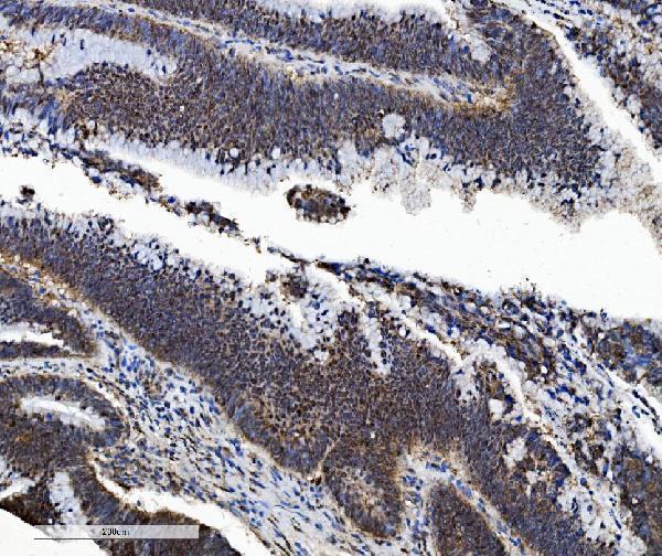 a03418 1 psmb5 primary antibodies ihc testing 6