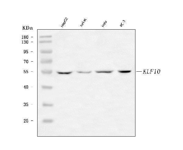  Western blot analysis of KLF10 using anti-KLF10 antibody (A03419-2)