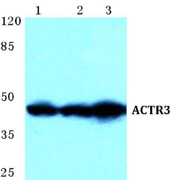 Western blot (WB) analysis of ACTR3 polyclonal antibody at 1:500 dilution
Lane1:Hela cell lysate
Lane2:NIH-3T3 cell lysate
Lane3:PC12 cell lysate
