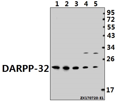 Western blot (WB) analysis of DARPP-32 (P69) pAb at 1:500 dilution
Lane1:PC3 whole cell lysate(40ug)
Lane2:HCT116 whole cell lysate(40ug)
Lane3:MCF-7 whole cell lysate(40ug)
Lane4:CT26 whole cell lysate(40ug)
Lane5:PC12 whole cell lysate(40ug)