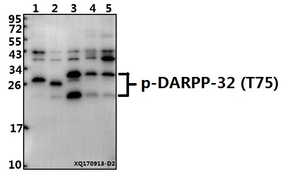 Western blot (WB) analysis of p-DARPP-32 (T75) pAb at 1:1000 dilution
Lane1:AML-12 whole cell lysate(40ug)
Lane2:C6 whole cell lysate(40ug)
Lane3:HepG2 whole cell lysate(40ug)
Lane4:SGC7901 whole cell lysate(40ug)
Lane5:PC3 whole cell lysate(40ug)