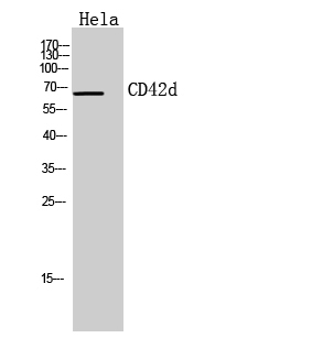 Immunohistochemical analysis of paraffin-embedded human-tonsils, antibody was diluted at 1:100