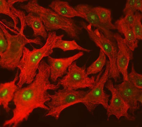 a03426 2 supt5h primary antibodies if testing 5