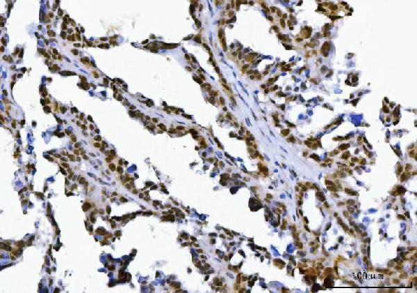  IHC analysis of SPT5/SUPT5H using anti-SPT5/SUPT5H antibody (A03426-2)