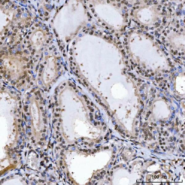  IHC analysis of SPT5/SUPT5H using anti-SPT5/SUPT5H antibody (A03426-2)