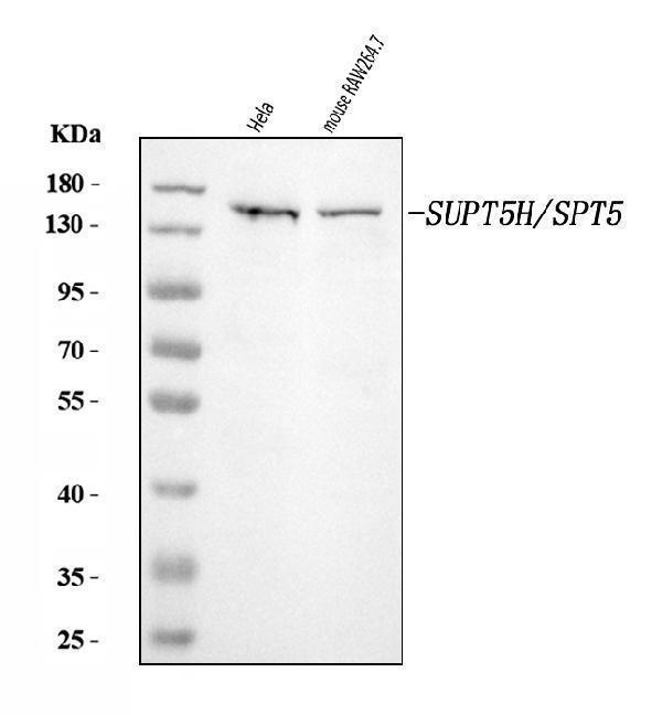 Western blot analysis of SPT5/SUPT5H using anti-SPT5/SUPT5H antibody (A03426-2)