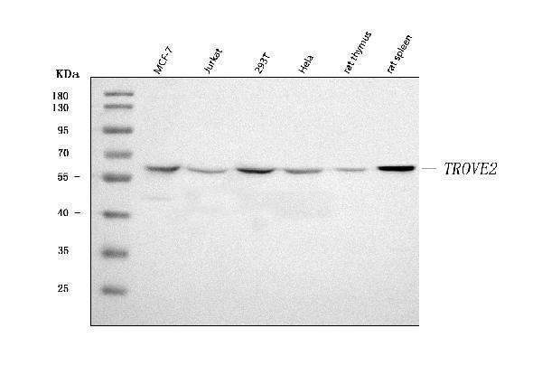  Western blot analysis of TROVE2/SS-A/RO60 using anti-TROVE2/SS-A/RO60 antibody (A03428-1)
