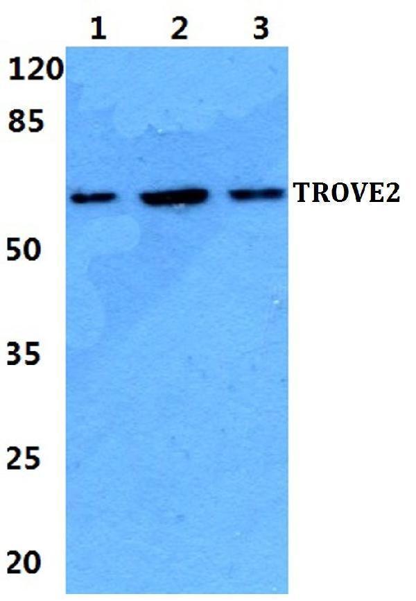 a03428 trove2 primary antiboties wb testing 1