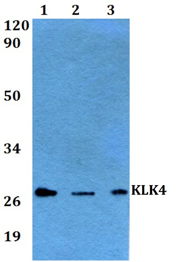 Western blot (WB) analysis of KLK4 polyclonal antibody at 1:500 dilution
Lane1:A549 whole cell lysate
Lane2:sp2/0 whole cell lysate 
Lane3:H9C2 whole cell lysate 