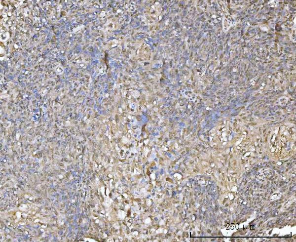  IHC analysis of XAF1 using anti-XAF1 antibody (A03432-1)