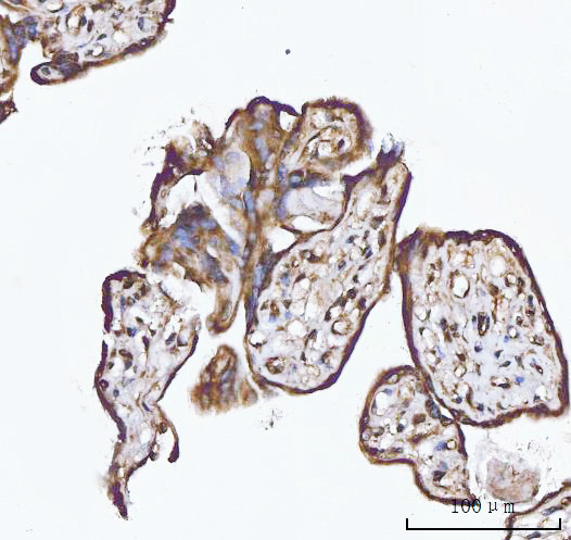  IHC analysis of XAF1 using anti-XAF1 antibody (A03432-1)