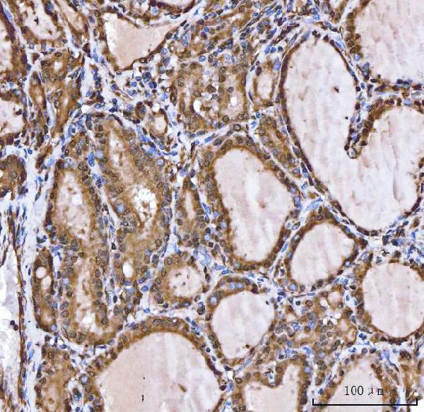 a03432 1 xaf1 primary antibodies ihc testing 4