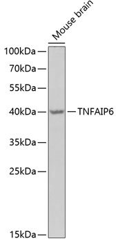 a03433 2 tnfaip6 primary antiboties wb testing 1