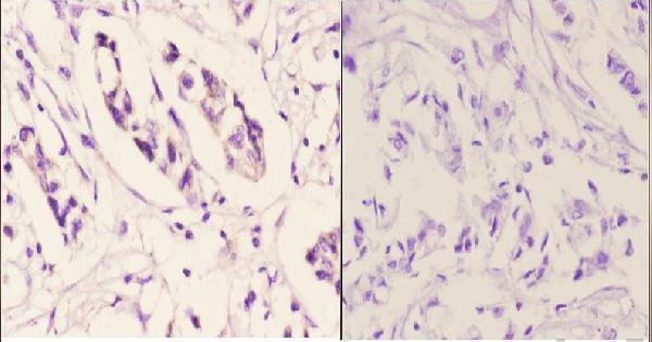 a03433 tnfaip6 primary antiboties ihc testing 2