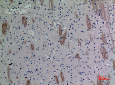 Immunohistochemical analysis of paraffin-embedded mouse-brain, antibody was diluted at 1:100