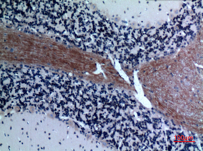 Immunohistochemical analysis of paraffin-embedded rat-brain, antibody was diluted at 1:100