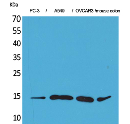 Western Blot analysis of PC-3, A549, OVCAR3, mouse colon cells using Eotaxin-3 Polyclonal Antibody