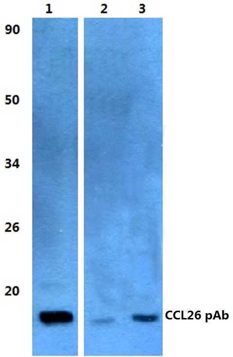 Western blot (WB) analysis of CCL26 polyclonal antibody at 1:500 dilution
Lane1:HEK293T whole cell lysate
Lane2:sp2/0 whole cell lysate
Lane3:H9C5 whole cell lysate