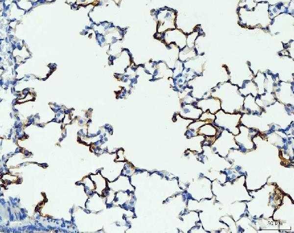  IHC analysis of RAGE/AGER using anti-RAGE/AGER antibody (A03438-1)