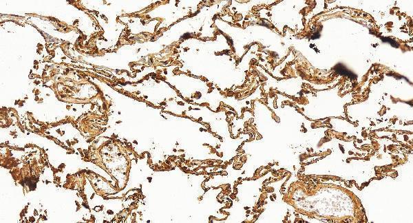 IHC analysis of RAGE/AGER using anti-RAGE/AGER antibody (A03438-1)