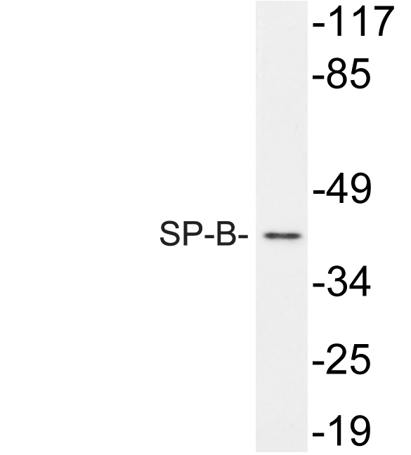 a03441 sftpb primary antibodies wb testing 3