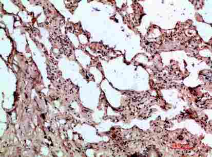 Immunohistochemical analysis of paraffin-embedded human-lung, antibody was diluted at 1:200