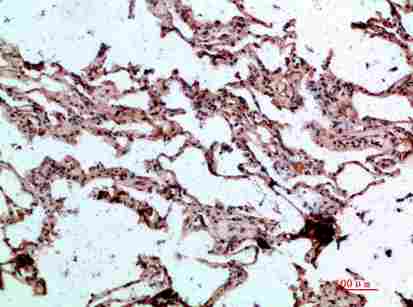 Immunohistochemical analysis of paraffin-embedded human-lung, antibody was diluted at 1:200