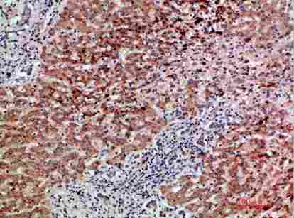 a03443 1 gdf2 primary antibodyes ihc testing 4