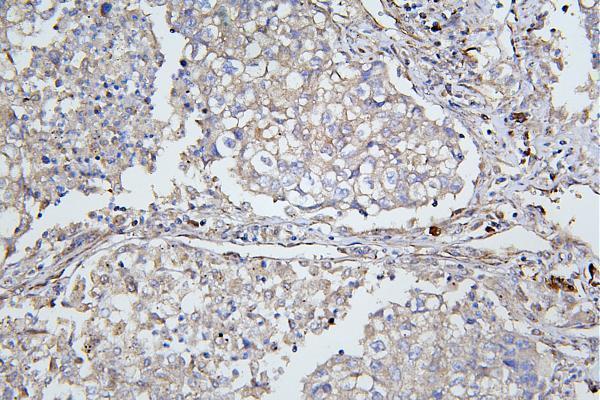  IHC analysis of ApoER2/LRP8 using anti-ApoER2/LRP8 antibody (A03444-2)