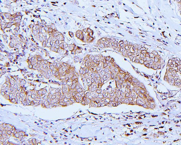 IHC analysis of ApoER2/LRP8 using anti-ApoER2/LRP8 antibody (A03444-2)