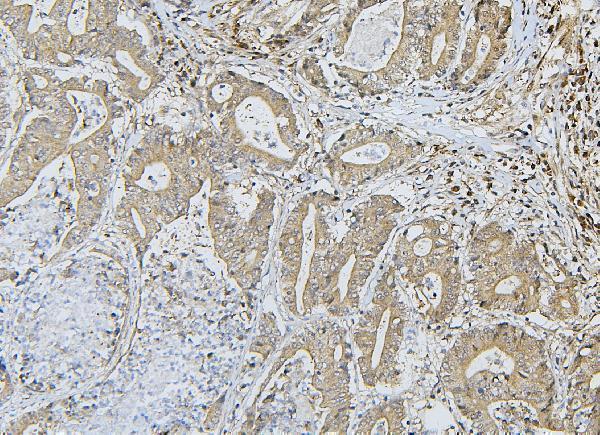 a03444 2 lrp8 primary antibodies ihc testing 4