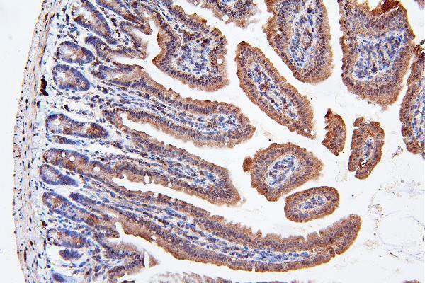 a03444 2 lrp8 primary antibodies ihc testing 5