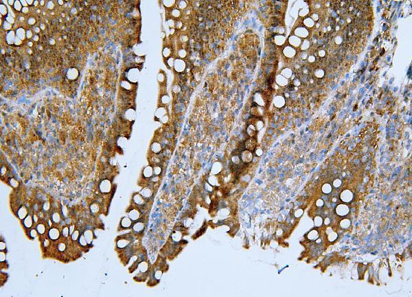 a03444 2 lrp8 primary antibodies ihc testing 6