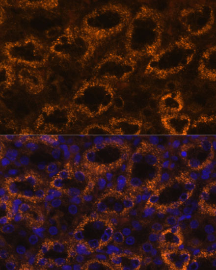 Immunofluorescence analysis of rat kidney using SLC7A9 antibody  at dilution of 1:100