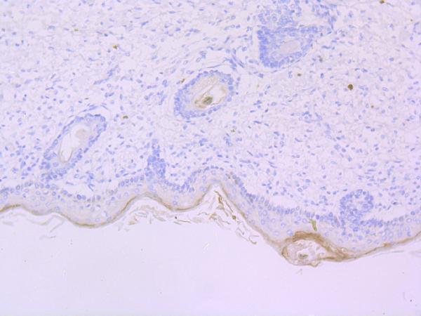 Immunohistochemical analysis of paraffin-embedded human skin tissue using anti- Mast Cell Chymase antibody
