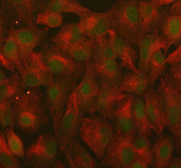  IF analysis of RANBP9 using anti-RANBP9 antibody (A03448-1) and anti-Beta Tubulin antibody (M01857-3)