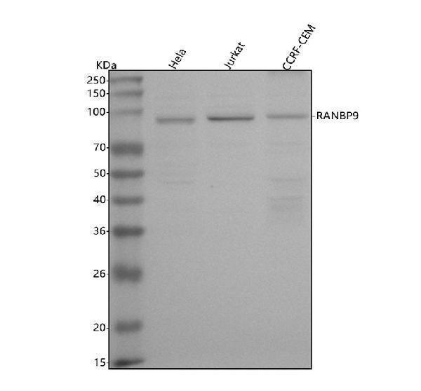  Western blot analysis of RANBP9 using anti-RANBP9 antibody (A03448-1)