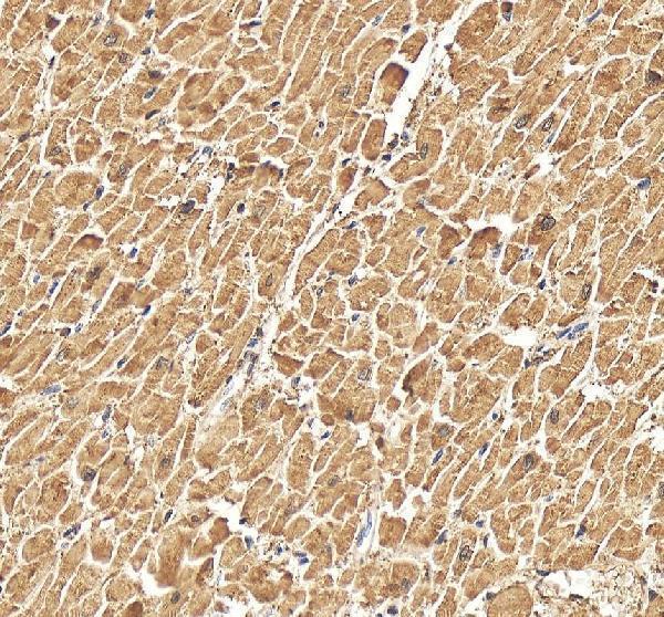 IHC analysis of CKM using anti-CKM antibody (A03452-1)