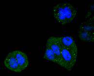 ICC staining DYNLL1 in Hela cells (green)