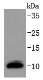 Western blot analysis of DYNLL1 on MCF-7 cells lysates using anti-DYNLL1 antibody at 1/1,000 dilution