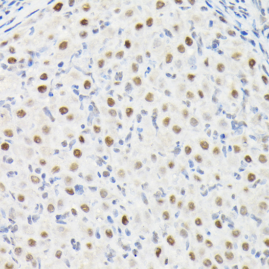 a03454 dynll1 primary antiboties ihc testing 2