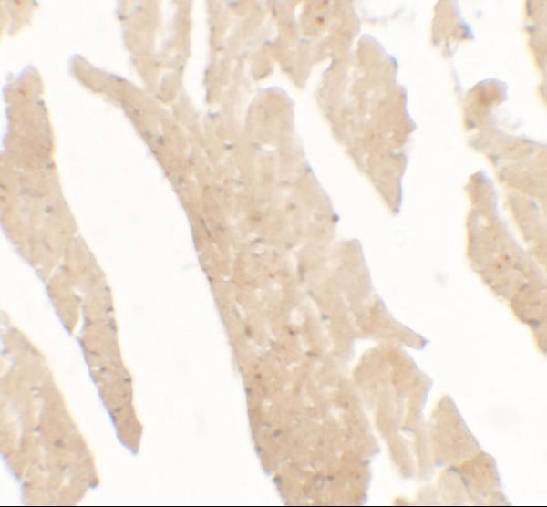 Immunohistochemistry of IL-36RN in rat small intestine tissue with IL-36RN antibody at 5 μg/mL