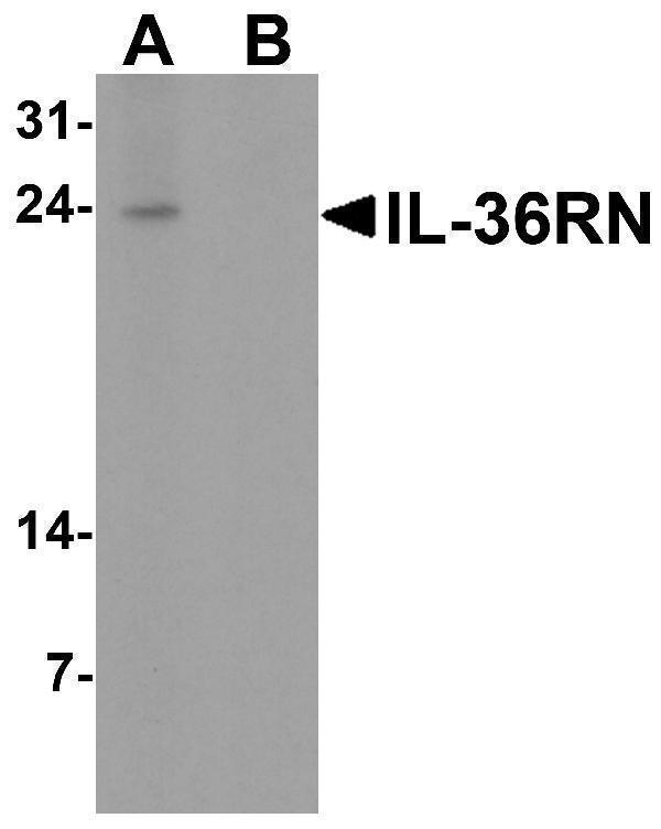Western blot analysis of IL-36RN in human spleen tissue lysate with IL-36RN antibody at 1 μg/ml in (A) the absence and (B) the presence of blocking peptide