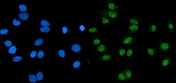 a03457 1 rnf20 primary antibodies if testing 2
