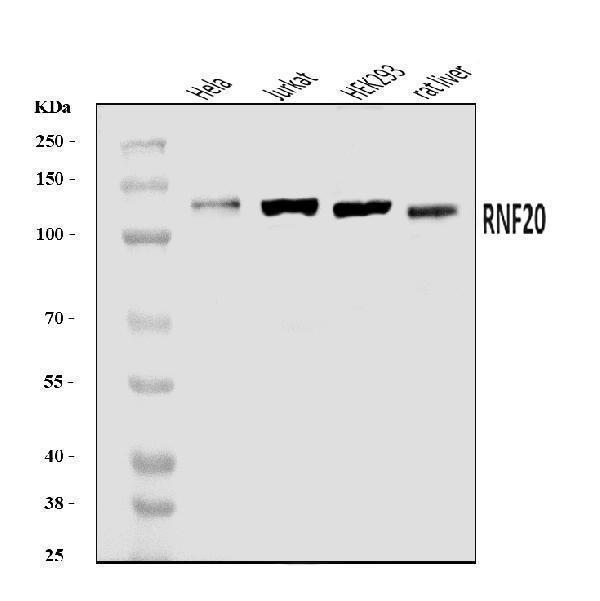 a03457 1 rnf20 primary antibodies wb testing 1