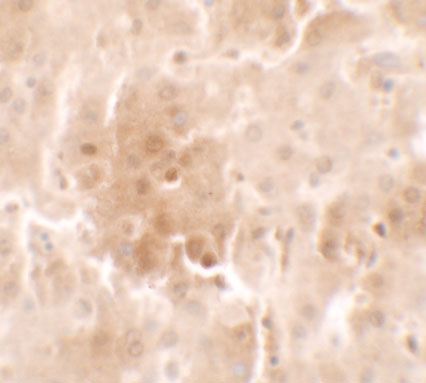 a03457 rnf20 primary antibodies ihc testing 2