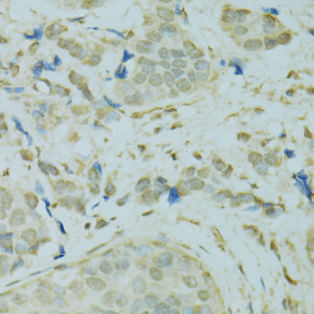 Immunohistochemistry of paraffin-embedded human colon using SAFB Rabbit pAb  at dilution of 1:200 