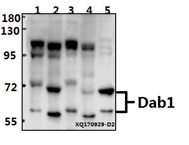 Western blot (WB) analysis of Dab1 (Q226) pAb at 1:500 dilution
Lane1:MCF-7 whole cell lysate(40ug)
Lane2:Hela whole cell lysate(40ug)
Lane3:SGC7901 whole cell lysate(40ug)
Lane4:PC12 whole cell lysate(40ug)
Lane5:The Brain tissue lysate of Mouse(40ug)
