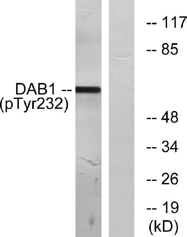 a03459y232 dab1 primary antibodies wb testing 2