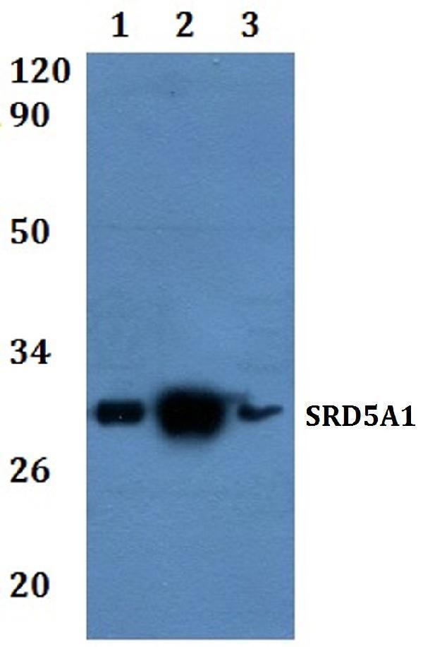 a03464 1 srd5a1 primary antiboties wb testing 1